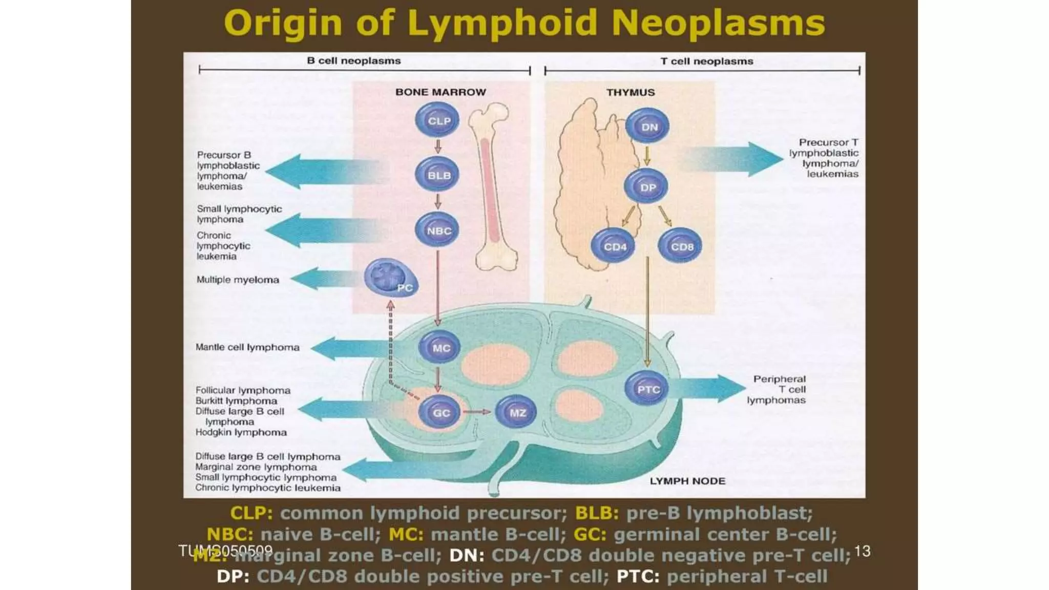 Myeloid neoplasm . Dr. Abhinav Golla , Associate Professor , Lab Director & Consultant Pathologist . Aadhya Medicure Pathlabs .