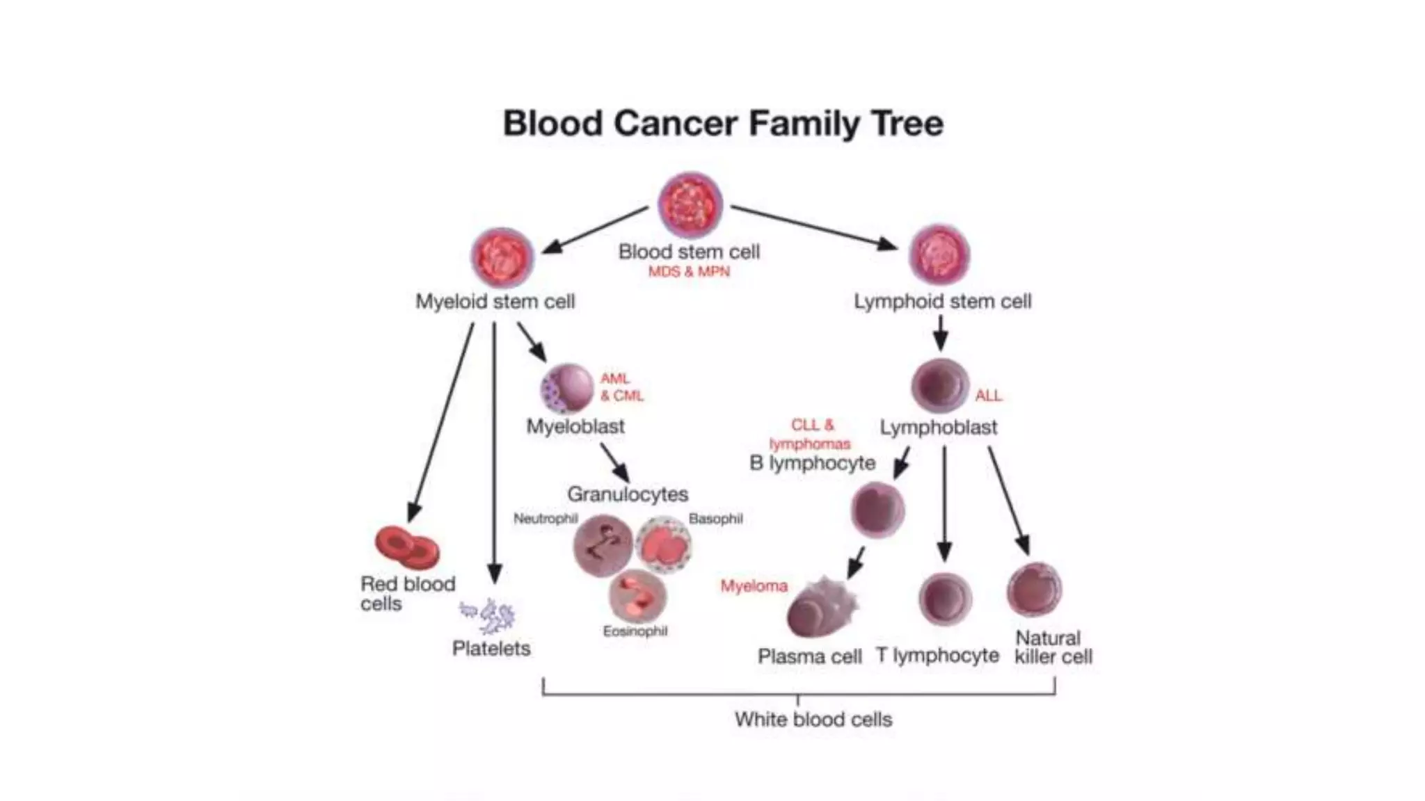 Myeloid neoplasm . Dr. Abhinav Golla , Associate Professor , Lab Director & Consultant Pathologist . Aadhya Medicure Pathlabs .
