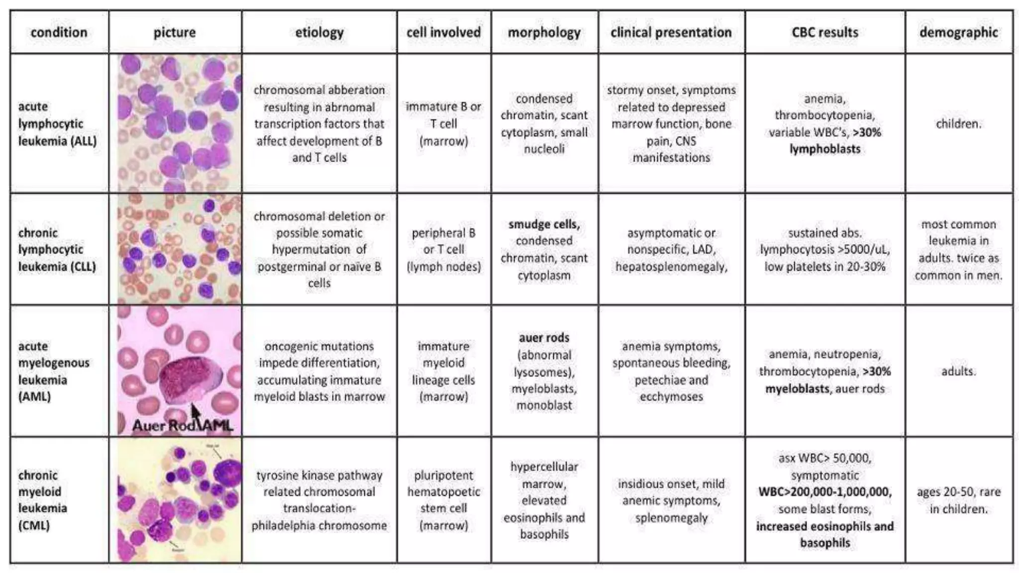 Myeloid neoplasm . Dr. Abhinav Golla , Associate Professor , Lab Director & Consultant Pathologist . Aadhya Medicure Pathlabs .