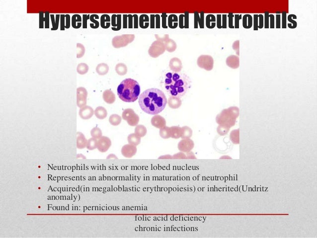 Wbc & platelets anomalies