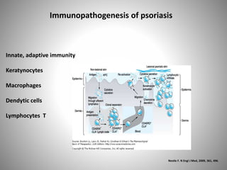 Immunopathogenesis of psoriasis
Nestle F. N Engl J Med, 2009, 361, 496.
Innate, adaptive immunity
Keratynocytes
Macrophages
Dendytic cells
Lymphocytes T
 