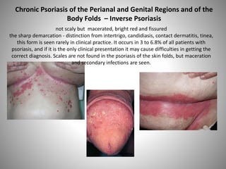 not scaly but macerated, bright red and fissured
the sharp demarcation - distinction from intertrigo, candidiasis, contact dermatitis, tinea,
this form is seen rarely in clinical practice. It occurs in 3 to 6.8% of all patients with
psoriasis, and if it is the only clinical presentation it may cause difficulties in getting the
correct diagnosis. Scales are not found in the psoriasis of the skin folds, but maceration
and secondary infections are seen.
Chronic Psoriasis of the Perianal and Genital Regions and of the
Body Folds – Inverse Psoriasis
 