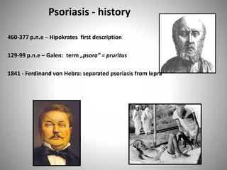 Psoriasis - history
460-377 p.n.e – Hipokrates first description
129-99 p.n.e – Galen: term „psora” = pruritus
1841 - Ferdinand von Hebra: separated psoriasis from lepra
 