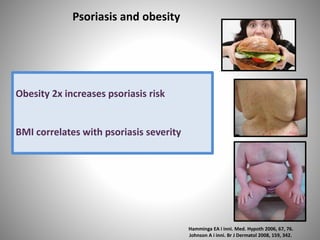 Psoriasis and obesity
Hamminga EA i inni. Med. Hypoth 2006, 67, 76.
Johnson A i inni. Br J Dermatol 2008, 159, 342.
Obesity 2x increases psoriasis risk
BMI correlates with psoriasis severity
 