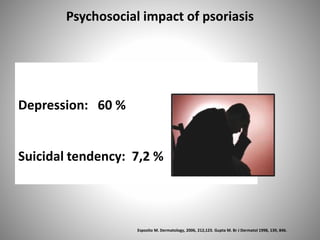 Depression: 60 %
Suicidal tendency: 7,2 %
Psychosocial impact of psoriasis
Esposito M. Dermatology, 2006, 212,123. Gupta M. Br J Dermatol 1998, 139, 846.
 