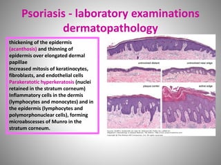 thickening of the epidermis
(acanthosis) and thinning of
epidermis over elongated dermal
papillae
Increased mitosis of keratinocytes,
fibroblasts, and endothelial cells
Parakeratotic hyperkeratosis (nuclei
retained in the stratum corneum)
Inflammatory cells in the dermis
(lymphocytes and monocytes) and in
the epidermis (lymphocytes and
polymorphonuclear cells), forming
microabscesses of Munro in the
stratum corneum.
Psoriasis - laboratory examinations
dermatopathology
 
