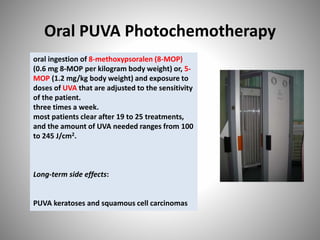 oral ingestion of 8-methoxypsoralen (8-MOP)
(0.6 mg 8-MOP per kilogram body weight) or, 5-
MOP (1.2 mg/kg body weight) and exposure to
doses of UVA that are adjusted to the sensitivity
of the patient.
three times a week.
most patients clear after 19 to 25 treatments,
and the amount of UVA needed ranges from 100
to 245 J/cm2.
Long-term side effects:
PUVA keratoses and squamous cell carcinomas
Oral PUVA Photochemotherapy
 