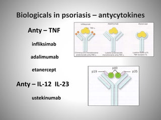 Anty – TNF
infliksimab
adalimumab
etanercept
Anty – IL-12 IL-23
ustekinumab
Biologicals in psoriasis – antycytokines
 