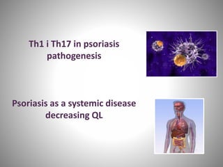 Th1 i Th17 in psoriasis
pathogenesis
Psoriasis as a systemic disease
decreasing QL
 