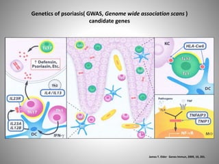 Genetics of psoriasis( GWAS, Genome wide association scans )
candidate genes
James T. Elder. Genes Immun, 2009, 10, 201.
 