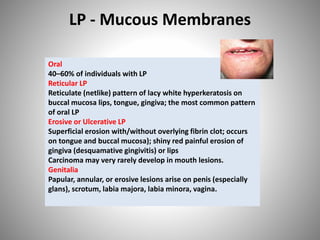 LP - Mucous Membranes
Oral
40–60% of individuals with LP
Reticular LP
Reticulate (netlike) pattern of lacy white hyperkeratosis on
buccal mucosa lips, tongue, gingiva; the most common pattern
of oral LP
Erosive or Ulcerative LP
Superficial erosion with/without overlying fibrin clot; occurs
on tongue and buccal mucosa); shiny red painful erosion of
gingiva (desquamative gingivitis) or lips
Carcinoma may very rarely develop in mouth lesions.
Genitalia
Papular, annular, or erosive lesions arise on penis (especially
glans), scrotum, labia majora, labia minora, vagina.
 
