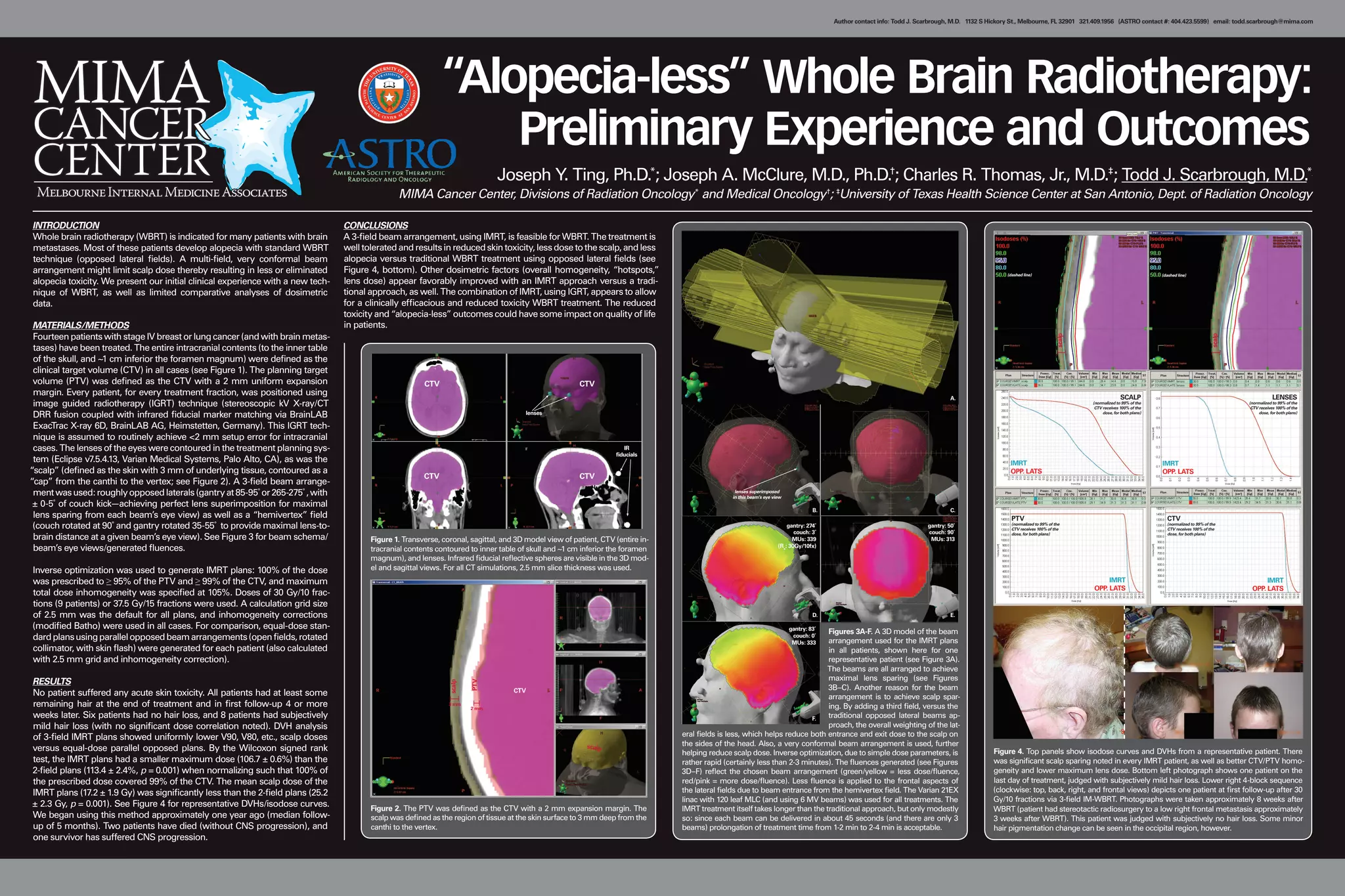 Alopecia less Whole Brain Radiotherapy Preliminary Experience And alopecia less whole brain radiotherapy preliminary experience and