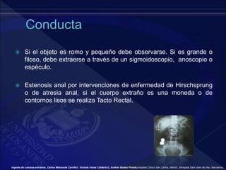  Si el objeto es romo y pequeño debe observarse. Si es grande o
filoso, debe extraerse a través de un sigmoidoscopio, anoscopio o
espéculo.
 Estenosis anal por intervenciones de enfermedad de Hirschsprung
o de atresia anal, si el cuerpo extraño es una moneda o de
contornos lisos se realiza Tacto Rectal.
Ingesta de cuerpos extraños, Carlos Maluenda Carrillo1, Vicente Varea Calderón2, Andrés Bodas Pinedo,Hospital Clínico San Carlos, Madrid. 2Hospital Sant Joan de Déu. Barcelona.
 