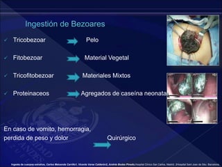  Tricobezoar Pelo
 Fitobezoar Material Vegetal
 Tricofitobezoar Materiales Mixtos
 Proteinaceos Agregados de caseína neonatal.
En caso de vomito, hemorragia,
perdida de peso y dolor Quirúrgico
Ingesta de cuerpos extraños, Carlos Maluenda Carrillo1, Vicente Varea Calderón2, Andrés Bodas Pinedo,Hospital Clínico San Carlos, Madrid. 2Hospital Sant Joan de Déu. Barcelona.
 