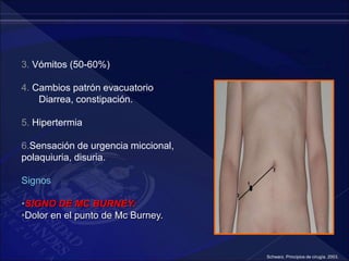 3. Vómitos (50-60%)
4. Cambios patrón evacuatorio
Diarrea, constipación.
5. Hipertermia
6.Sensación de urgencia miccional,
polaquiuria, disuria.
Signos
•SIGNO DE MC BURNEY:
•Dolor en el punto de Mc Burney.
Schwarz. Principios de cirugía. 2003.
 