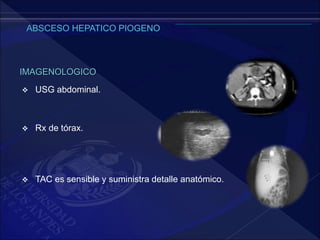  USG abdominal.
 Rx de tórax.
 TAC es sensible y suministra detalle anatómico.
IMAGENOLOGICO
 