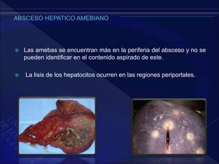  Las amebas se encuentran más en la periferia del absceso y no se
pueden identificar en el contenido aspirado de este.
 La lisis de los hepatocitos ocurren en las regiones periportales.
 