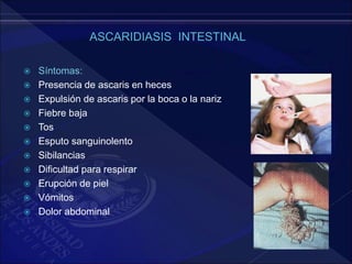  Síntomas:
 Presencia de ascaris en heces
 Expulsión de ascaris por la boca o la nariz
 Fiebre baja
 Tos
 Esputo sanguinolento
 Sibilancias
 Dificultad para respirar
 Erupción de piel
 Vómitos
 Dolor abdominal
 