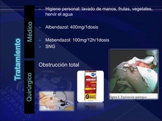 Médico
Quirúrgico
 Higiene personal: lavado de manos, frutas, vegetales,
hervir el agua
 Albendazol: 400mg/1dosis
 Mebendazol: 100mg/12h/1dosis
 SNG
Obstrucción total
 