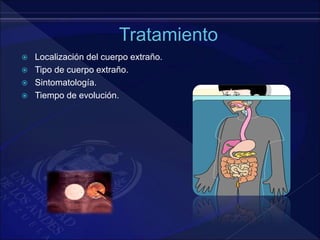  Localización del cuerpo extraño.
 Tipo de cuerpo extraño.
 Sintomatología.
 Tiempo de evolución.
 