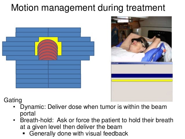 Technical Advances in radiotherapy for Lung (and liver) Cancer