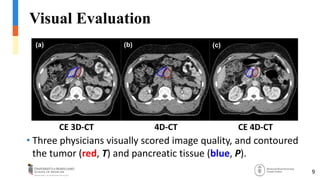 Individually Optimized Contrast-Enhanced 4D-CT for Radiotherapy ...