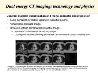 Dual energy CT in radiotherapy: Current applications and future outlook ...
