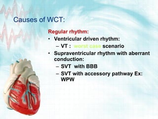 Causes of WCT: Regular rhythm: Ventricular driven rhythm: VT :  worst case  scenario Supraventricular rhythm with aberrant conduction: SVT  with BBB SVT with accessory pathway Ex: WPW 