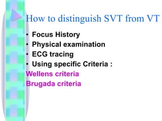How to distinguish SVT from VT Focus History Physical examination ECG tracing Using specific Criteria : Wellens criteria  Brugada criteria 