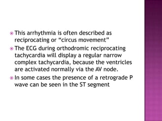 EP diagnosis of WIDE COMPLEX TACHYCARDIA | PPTX