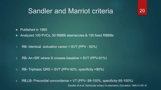 Sandler and Marriot criteria
 Published in 1965
 Analyzed 100 PVCs, 50 RBBB aberrancies & 100 fixed RBBBs
1. RB- Identical activation vector = SVT (PPV - 92%)
2. RB- An rSR’ where S crosses baseline = SVT (PPV-91%)
3. RB- Triphasic QRS = SVT (PPV-92%, specificity >90%)
4. RB,LB- Precordial concordance = VT (PPV- 89-100%, specificity-95-100%)
20
Sandler IA et al, Ventricular ectopy Vs aberration. Circulation 1965;31:551-6
 