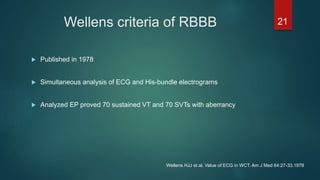 Wellens criteria of RBBB
 Published in 1978
 Simultaneous analysis of ECG and His-bundle electrograms
 Analyzed EP proved 70 sustained VT and 70 SVTs with aberrancy
21
Wellens HJJ et al, Value of ECG in WCT. Am J Med 64:27-33,1978
 