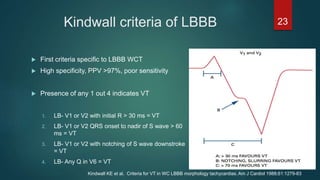 Kindwall criteria of LBBB
 First criteria specific to LBBB WCT
 High specificity, PPV >97%, poor sensitivity
 Presence of any 1 out 4 indicates VT
1. LB- V1 or V2 with initial R > 30 ms = VT
2. LB- V1 or V2 QRS onset to nadir of S wave > 60
ms = VT
3. LB- V1 or V2 with notching of S wave downstroke
= VT
4. LB- Any Q in V6 = VT
23
Kindwall KE et al. Criteria for VT in WC LBBB morphology tachycardias. Am J Cardiol 1988;61:1279-83
 