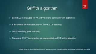 Griffith algorithm
 Each ECG is analyzed for V1 and V6 criteria consistent with aberration
 If the criteria for aberration are not found, VT is assumed
 Good sensitivity, poor specificity
 Drawback: RVOT tachycardias as misclassified as SVT by this algorithm
27
Griffith MJ et al. Ventricular tachycardia as default diagnosis in broad complex tachycardia. Lancet 1994;343:386-8
 
