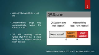 • 69% of VTs had QRSd > 140
ms
• Antiarrhythmic drugs may
nonspecifically widen the
QRSd of a SVT
• VT with relatively narrow
QRSd (120-140 ms)  more
likely in pts without structural
heart disease
6
Wellens HJJ et al, Value of ECG in WCT. Am J Med 64:27-33,1978
 