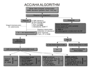 Wide QRS Complex Tachycardia (VT vs SVT) | PPTX