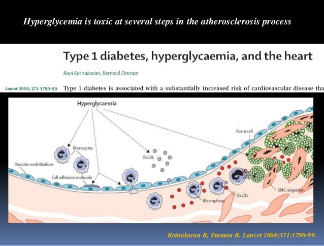 Lance thompson diabetes back