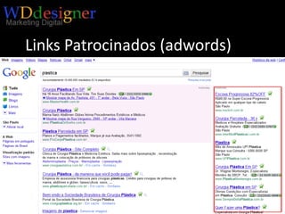 Links Patrocinados (adwords)