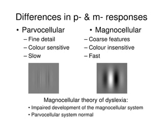 Differences in p- & m- responses
• Parvocellular
– Fine detail
– Colour sensitive
– Slow
• Magnocellular
– Coarse features
– Colour insensitive
– Fast
Magnocellular theory of dyslexia:
• Impaired development of the magnocellular system
• Parvocellular system normal
 