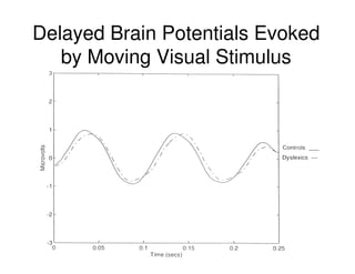 Delayed Brain Potentials Evoked
by Moving Visual Stimulus
 