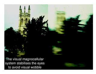 The visual magnocellular
system stabilises the eyes
to avoid visual wobble
 