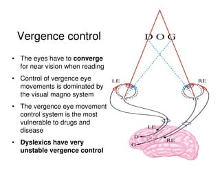 • The eyes have to converge
for near vision when reading
• Control of vergence eye
movements is dominated by
the visual magno system
• The vergence eye movement
control system is the most
vulnerable to drugs and
disease
• Dyslexics have very
unstable vergence control
Vergence control
 