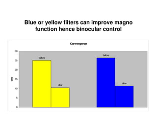 Blue or yellow filters can improve magno
function hence binocular control
Convergence
before
before
after
after
0
5
10
15
20
25
30
cms
 