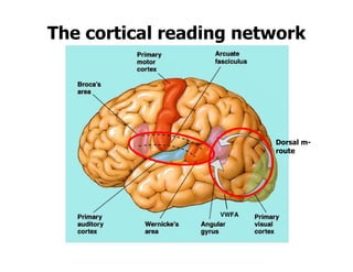 The cortical reading network
Dorsal m-
route
VWFA
 