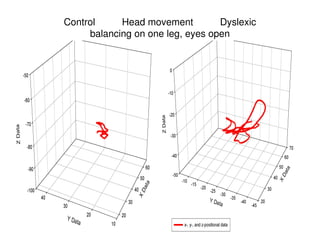 Control Head movement Dyslexic
balancing on one leg, eyes open
 