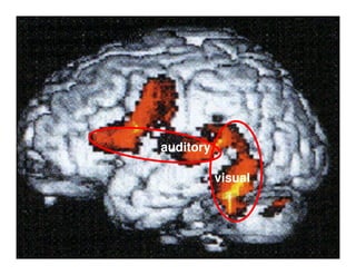 Left hemisphere language
areas that activate less in
dyslexics
auditory
visual
 