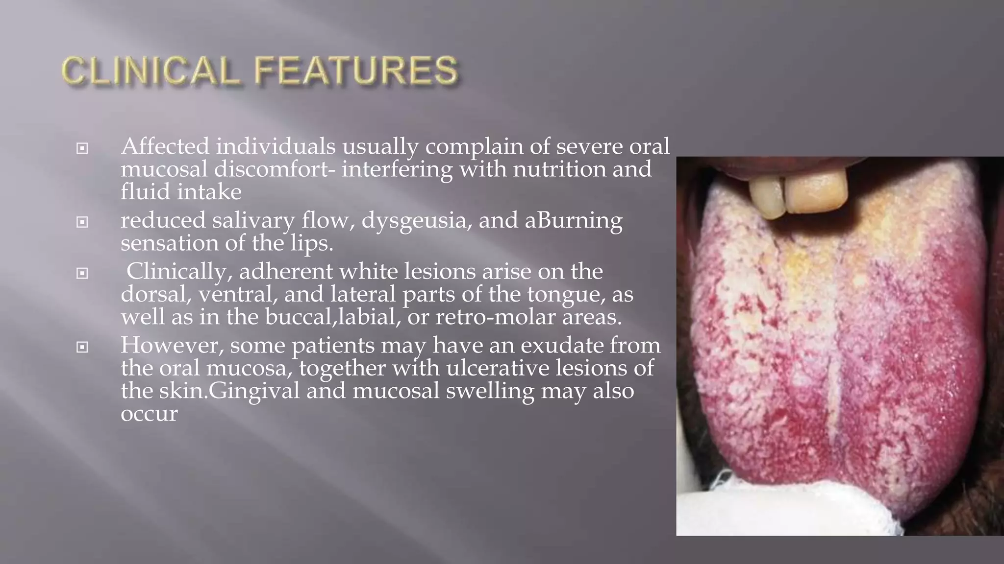 non-keratotic-white-lesions-of-the-oral-cavity-pptx