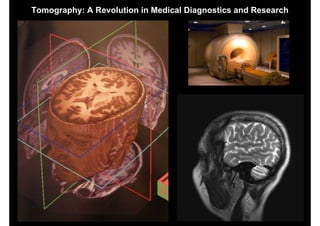 Tomography: A Revolution in Medical Diagnostics and Research




                                   The Future of Spaceborne Synthetic Aperture Radar
                         IGARSS 2010 - Special Session Honoring the Achievements of Kiyo Tomiyasu
 
