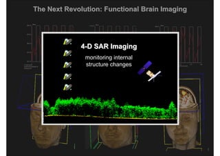 The Next Revolution: Functional Brain Imaging




             4-D SAR Imaging
               monitoring internal
               structure changes




                             The Future of Spaceborne Synthetic Aperture Radar
                   IGARSS 2010 - Special Session Honoring the Achievements of Kiyo Tomiyasu
 