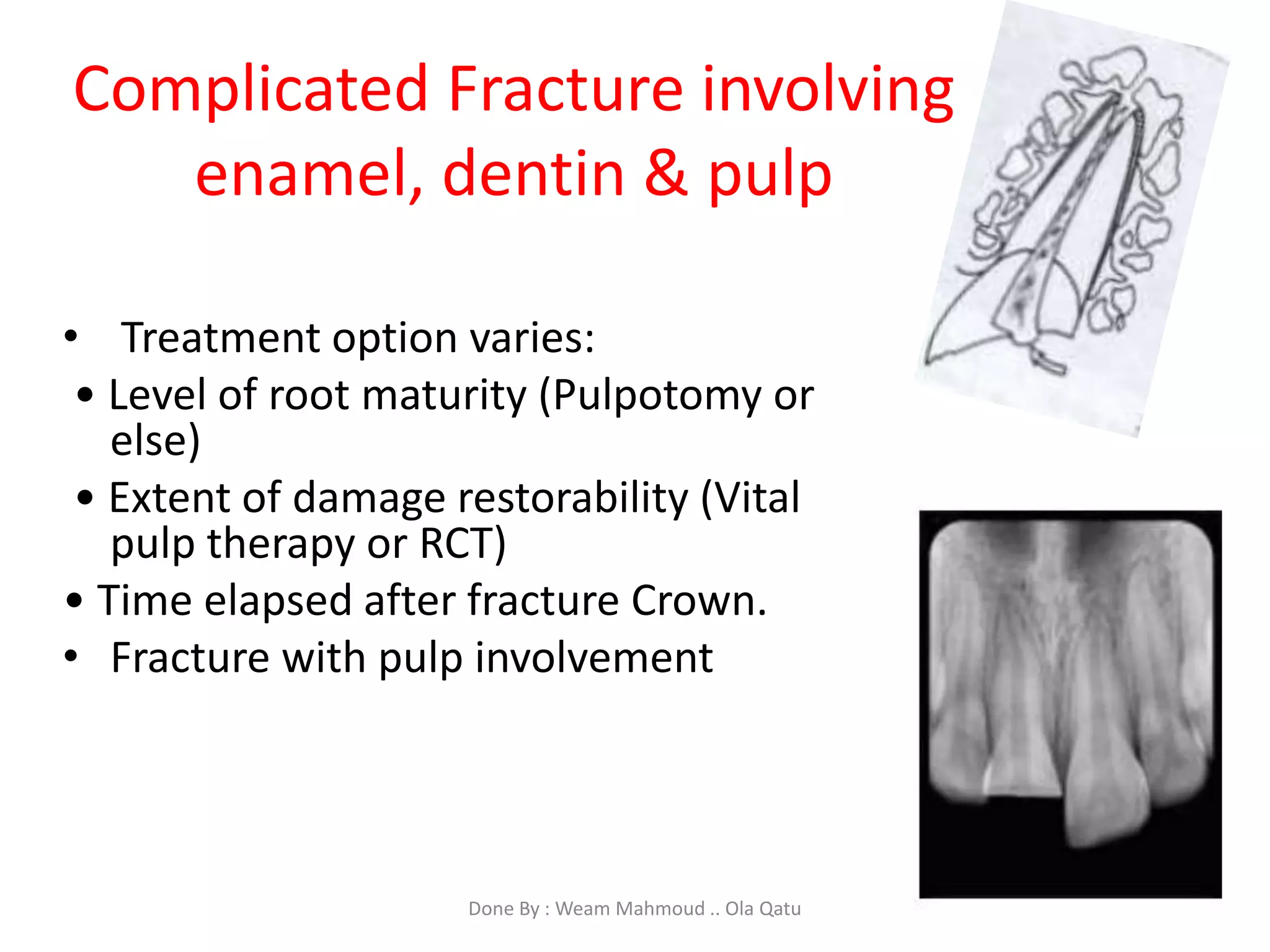 Dental Trauma | PPSX